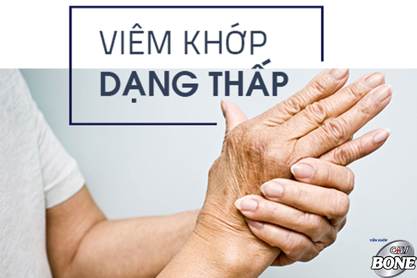 Thời gian điều trị bao lâu và tần suất kiểm tra trong phác đồ điều trị viêm khớp dạng thấp là như thế nào?
